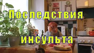 КАК ПРИГОТОВИТЬ КОСТЛЯВУЮ РЫБУ/ ПОСЛЕДСТВИЯ ИНСУЛЬТА/ 05 июня 2023