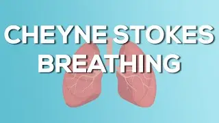Cheyne Stokes Breathing - Causes, Demonstration, Treatment