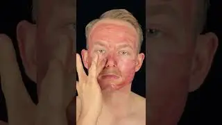 The Ordinary AHA 30% + BHA 2% Peeling Solution! The full review is on my channel 