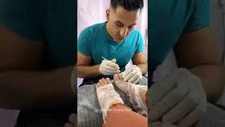 Brazzcare: How To 💜