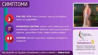🙌Лупусът е диагноза, a не присъда