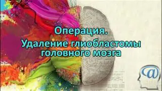 Surgery. Removal of a glioblastoma tumor. Fluoroscopy and neuromonitoring. Neurosurgery