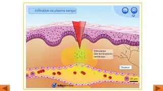 immunité naturelle : les barrières naturelles -la réaction inflammatoire et la phagocytose