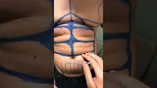 RESULTADO IMPRESSIONANTE 😱