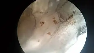 MICROSCÓPIO:Unha de Cachorro no microscópio.Dog's nail in the microscope.Ноготь собаки в микроскопе.