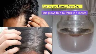 100% Natural 3 Hair Care Products for Hair Fall & Hair Greying - For Men & Women (Homemade)