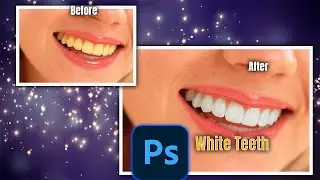 How To Whiten Teeth In Photoshop - TutorialWhite teeth
