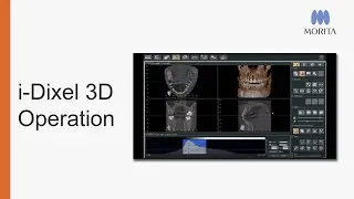 i-Dixel 3D Operation Webinar