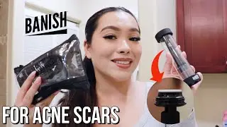 How I use the Banish Starter Kit