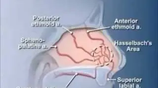Nasal Anatomi