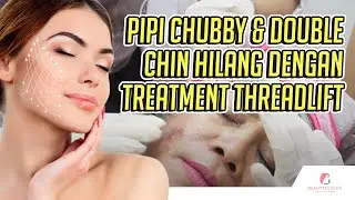 Pipi Chubby & Double Chin hilang dengan treatment Threadlift