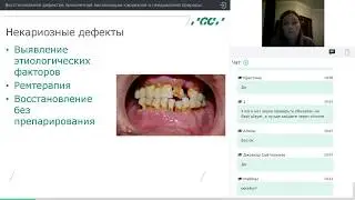 Пришеечные дефекты (Вебинар от 12.12.17)