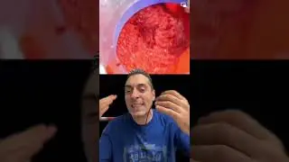 TI PIACE LA POLPA DI GRANCHIO? FORSE NON LO HAI MAI MANGIATO VERAMENTE, IL SURIMI E' QUALCOSA DI....