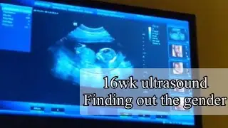 Reaction to baby #12 ultrasound| 16wk ultrasound