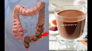 HOW To Clean Your Colon Naturally! Colon Cleanse at Home! natural cures colon cleansing