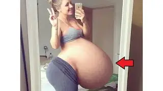 The woman felt something strange in her stomach. Doctors have never seen anything like this!