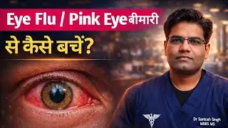 Eye Flu से कैसे बचें | Viral Conjunctitis Prevention..