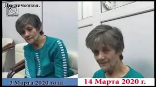 № 1009. Б. Паркинсона и многое другое. Лечение Методом RANC в Клинике 