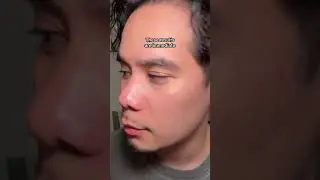 Look 10 years Younger!