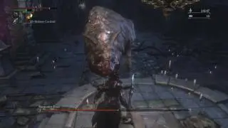 Bloodborne™_20170513221723
