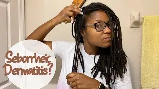 Brushing My Locs and How I Manage Seborrheic Dermatitis #loc #locjourney #seborrheicdermatitis