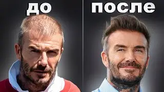 ПОСМОТРИ ЭТО ВИДЕО ЕСЛИ У ТЕБЯ ВЫПАДАЮТ ВОЛОСЫ