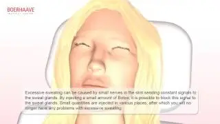 Fillers and botox Animations - Boerhaave Medical Centre