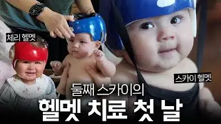 머리가 찌그러졌던 스카이가 드디어 헬멧 치료를 시작했어요!