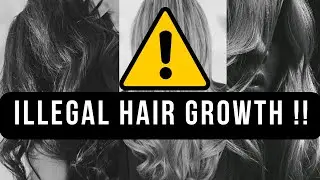 ⚠️ WARNING: TOO STRONG ⚠️ LISTEN ONLY ONCE  🚫 HYPER-ACCELERATED HAIR GROWTH [FORCED FORMULA] 🧬 