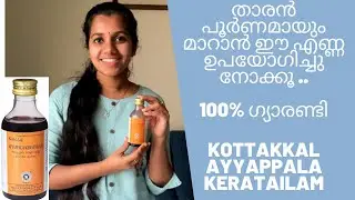 താരനും ,ത്വക്ക് രോഗങ്ങളും മാറാൻ ഉപയോഗിക്കു Kottakkal Ayyappala keratailam ...100% ഉറപ്പ് #haircare