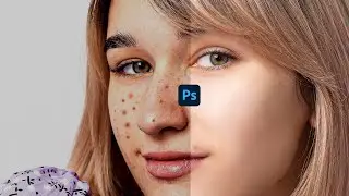 HOW TO CLEAN FACE IN PHOTOSHOP  | Photoshop Tutorials