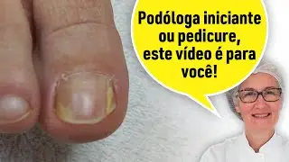 FUNGO NAS UNHAS É MUITO COMUM