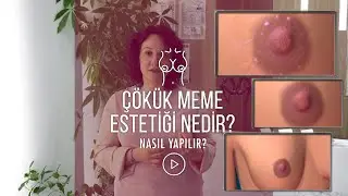 Çökük Meme Ucu Estetiği Nedir?