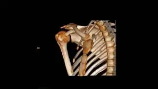 Ekstremite Tomografisi 003