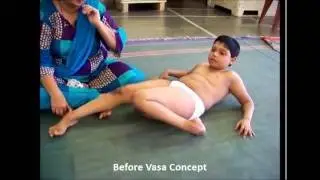 Parth Mane : Before-After video