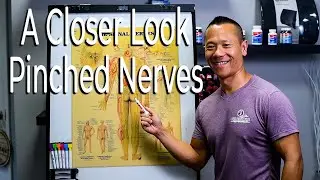 Pinched Nerves | What Are They and Where is Your Pain Coming From