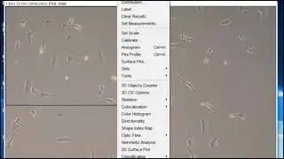 Cell counting and scale bars using ImageJ