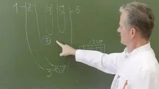 Пластика пахового канала по Лихтенштейну