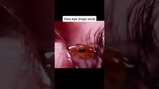 Slowmo
