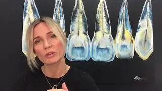 Myth: Crowded teeth are not a big deal