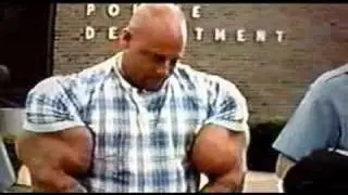 The Man Whose Arms Exploded Part 3