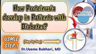 How Proteinuria develop in Patients with Diabetes? | USMLE STEP-I | STEP-II CK | IM & FM RESIDENTS