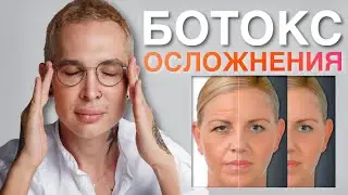 БОТОКС ОСЛОЖНЕНИЯ 