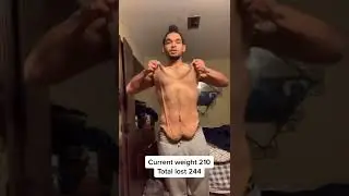 💯250lbs weight Lost #Shorts