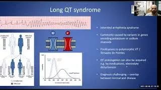 INTRODUCTION TO THE ECG | Session #6 | Long QT Syndrome