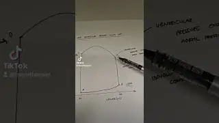 Left Ventricular Pressure Volume Loop