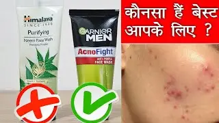 Garnier Acno fight VS Himalaya neem facewash | कौनसा है best facewash आपके दानों को साफ करने के लिए