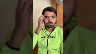 Jaw Dropping Bald Transition You Never Saw | Haircut For Winter | #transition #happydiwali