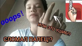 Я СЛОМАЛ ПАЛЕЦ!? ИЛИ ЖЕ ВСЁ ТАКИ ЭТО УШИБ!?