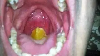 Me whole swallowing very big orange